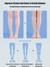 arch support orthopedic insoles